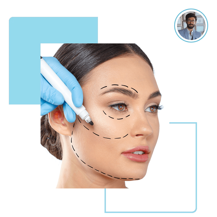 facelift-turkey