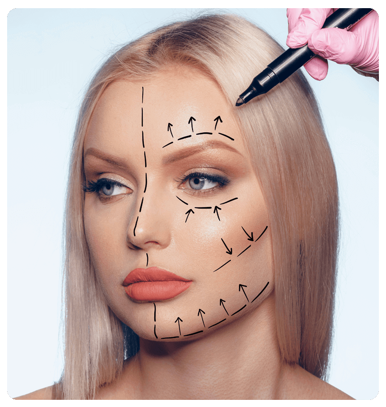 what-is-face-lift