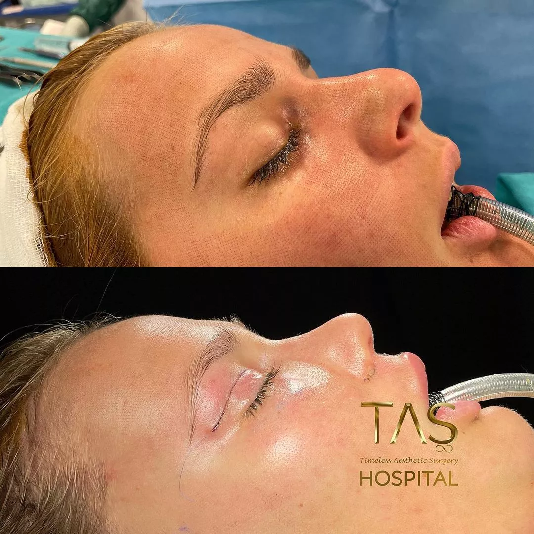 Case study by Dr. Suleyman Tas