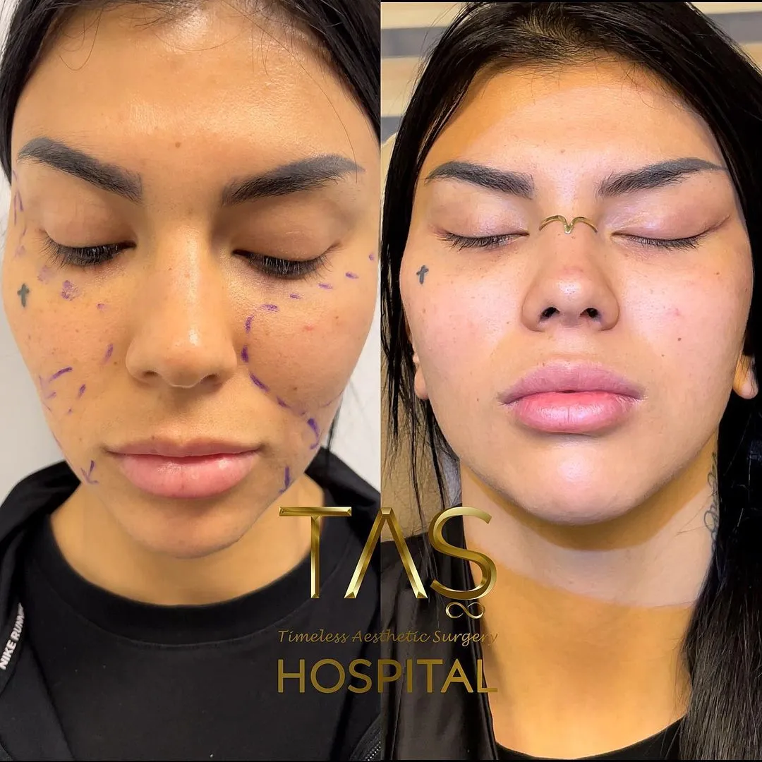 Case study br Dr. Suleyman Tas