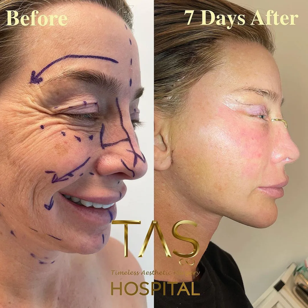 Case study by Dr. Suleyman Tas